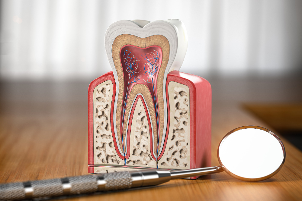 Root Canals Tuscaloosa, AL , Northport, AL
