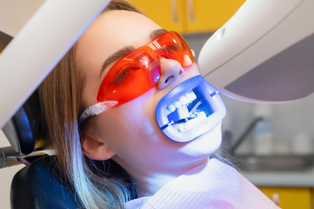 Teeth Whitening  Tuscaloosa, AL ,  Northport, AL